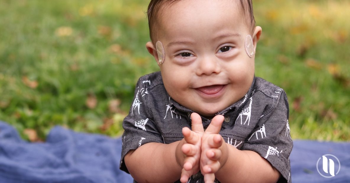 young boy with Down syndrome
